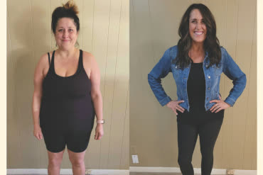 Christina B. before and after