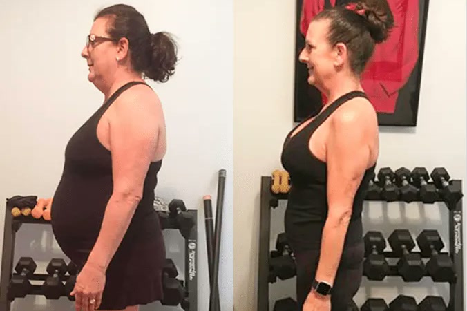 Diane O. before and after