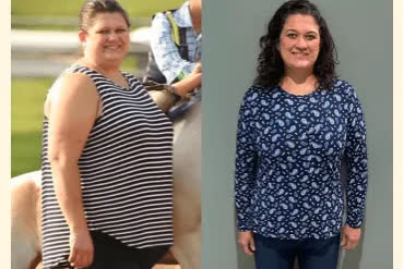 Jacqueline C. before and after